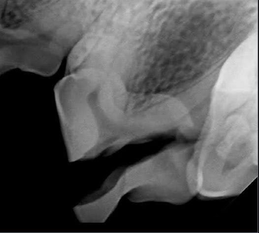 X-ray image of dog's split tooth