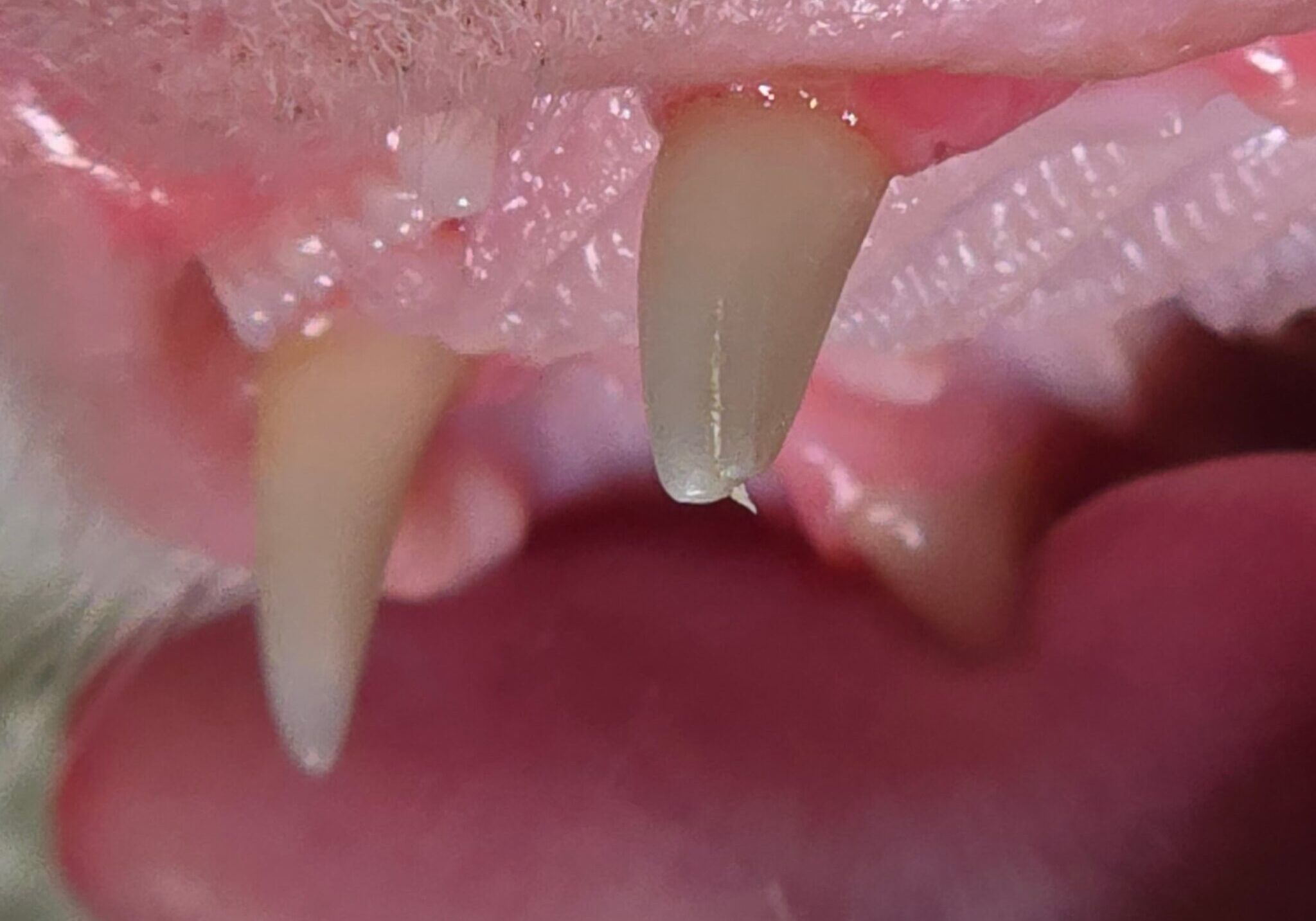 Intraoperative Image Of Reduced Crown Height