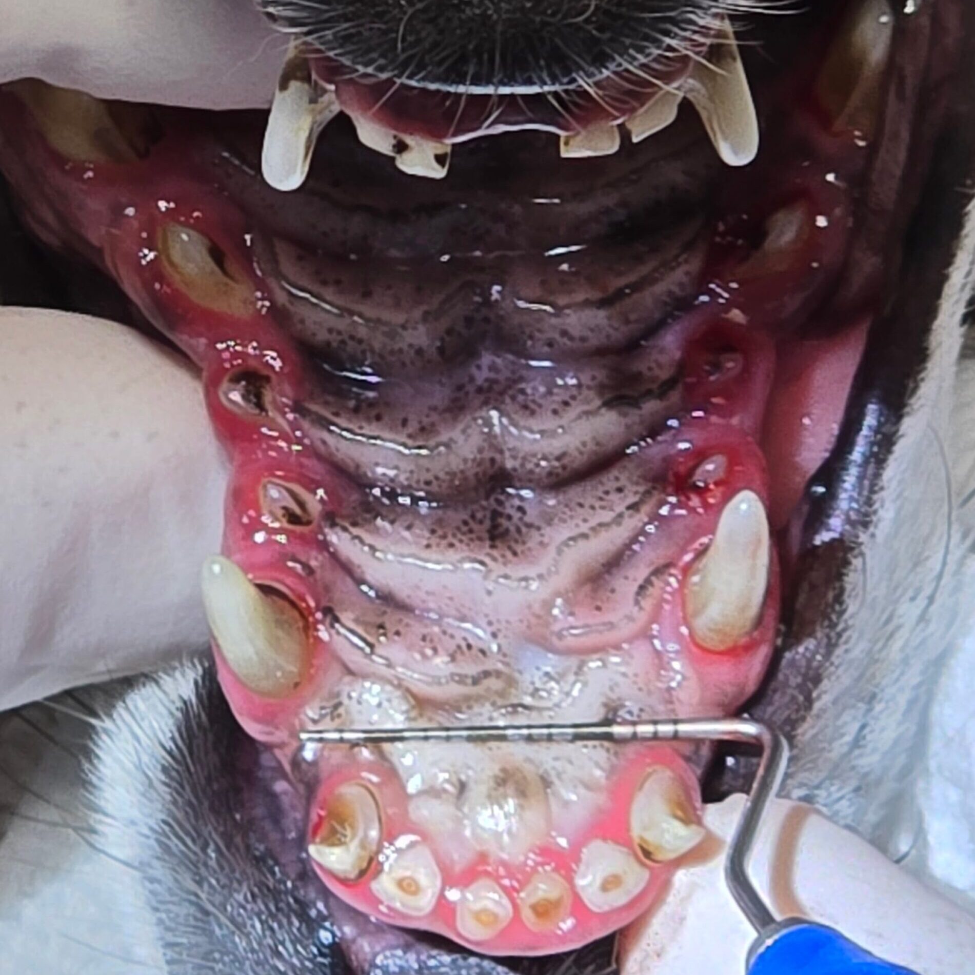 Intraoperative Photo Of Several Abraded Teeth And Fractured Lower Incisors