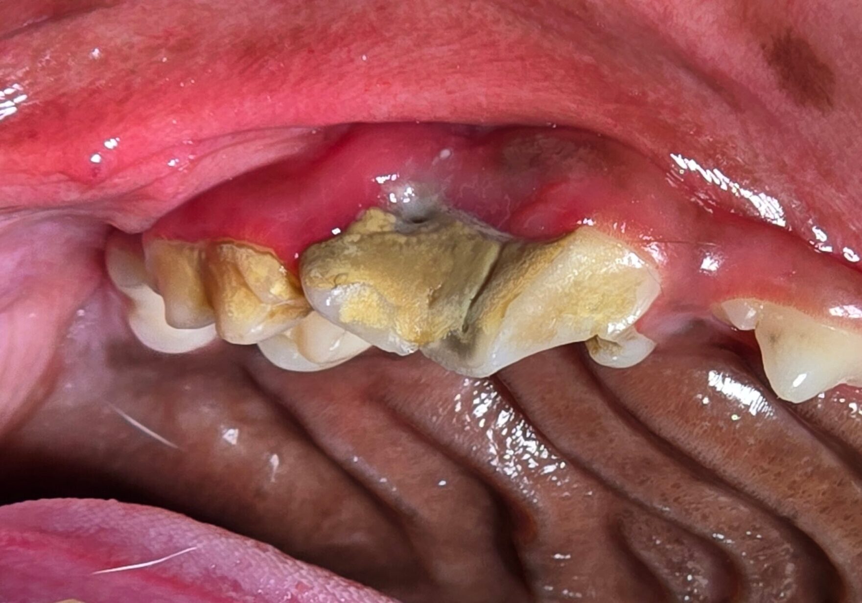 contralateral Carnassial Tooth With Irregular Gum Margin