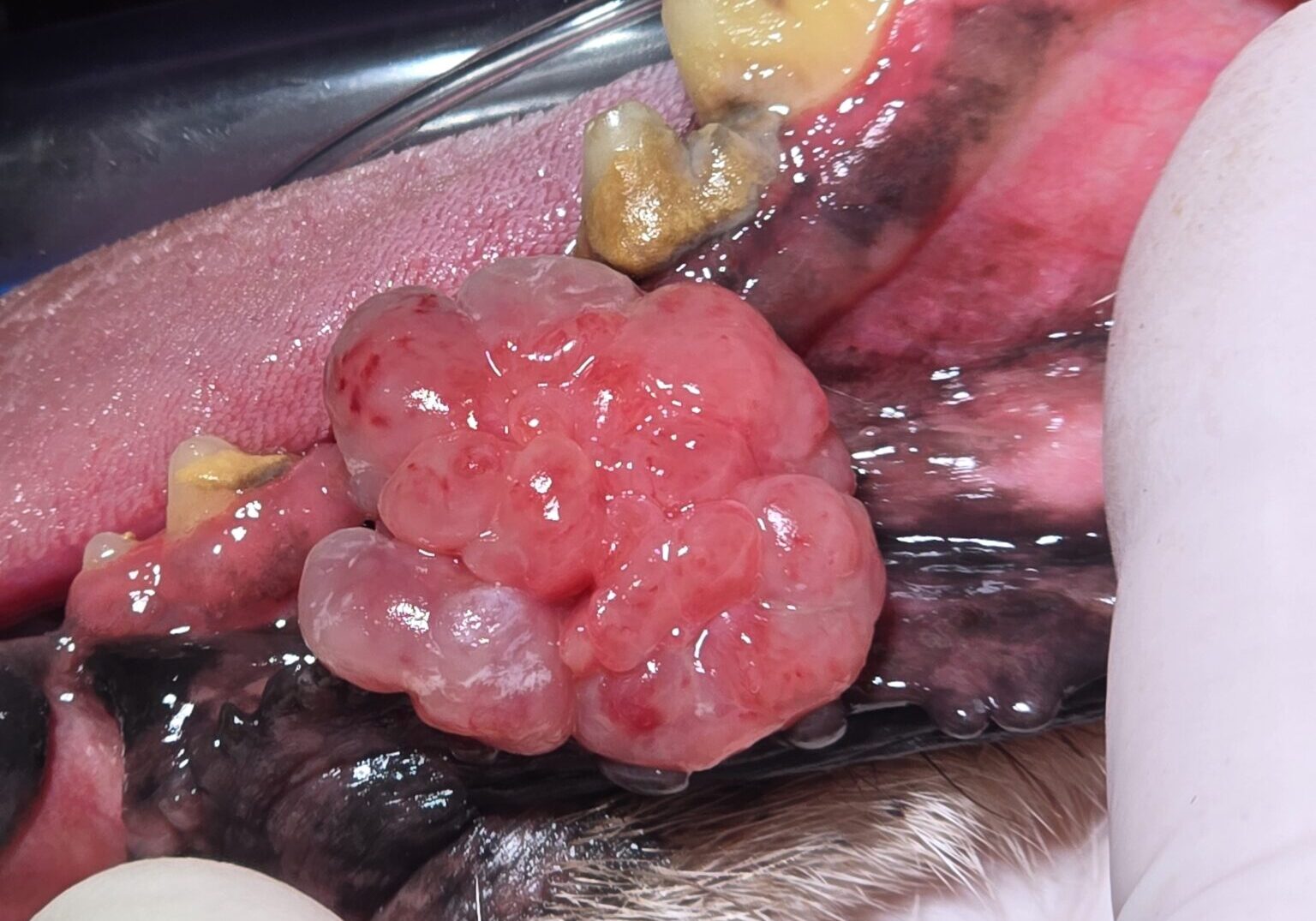 14 Year Old Patient Presented For A Rapidly Growing Mass In The Oral Cavity