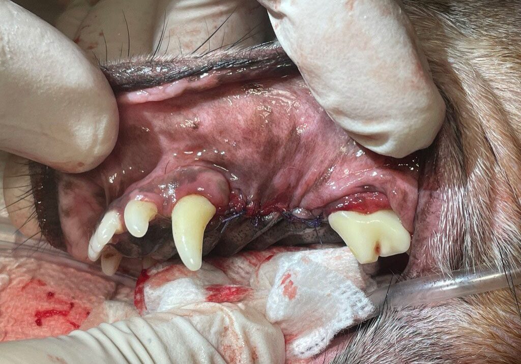 3.3.5. Post Operative Once Tooth Roots Surgically Removed And Site Closed With Disolvable Stitches