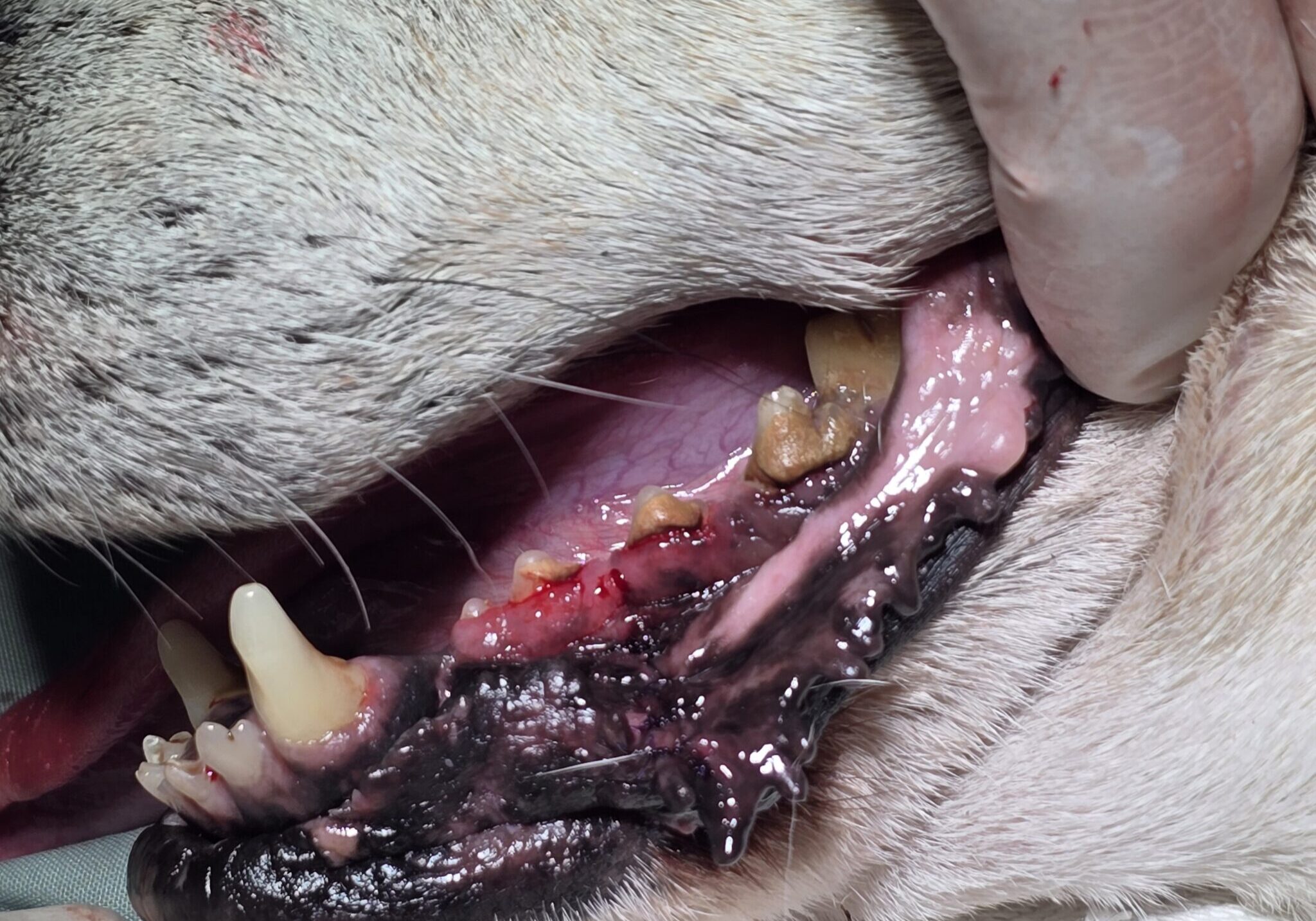 Post Operative Image Of Completely Removed Amelanotic Malignant Melanoma