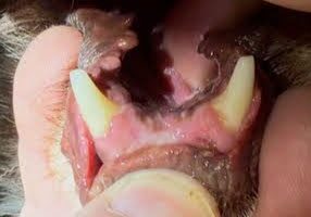 Post Operative Photo Of Completely Removed Oral Cancer3
