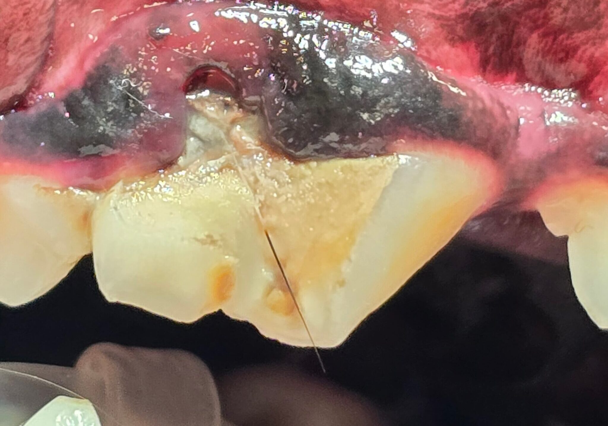 Preoperative Image Of Abnormal Tooth1 Min