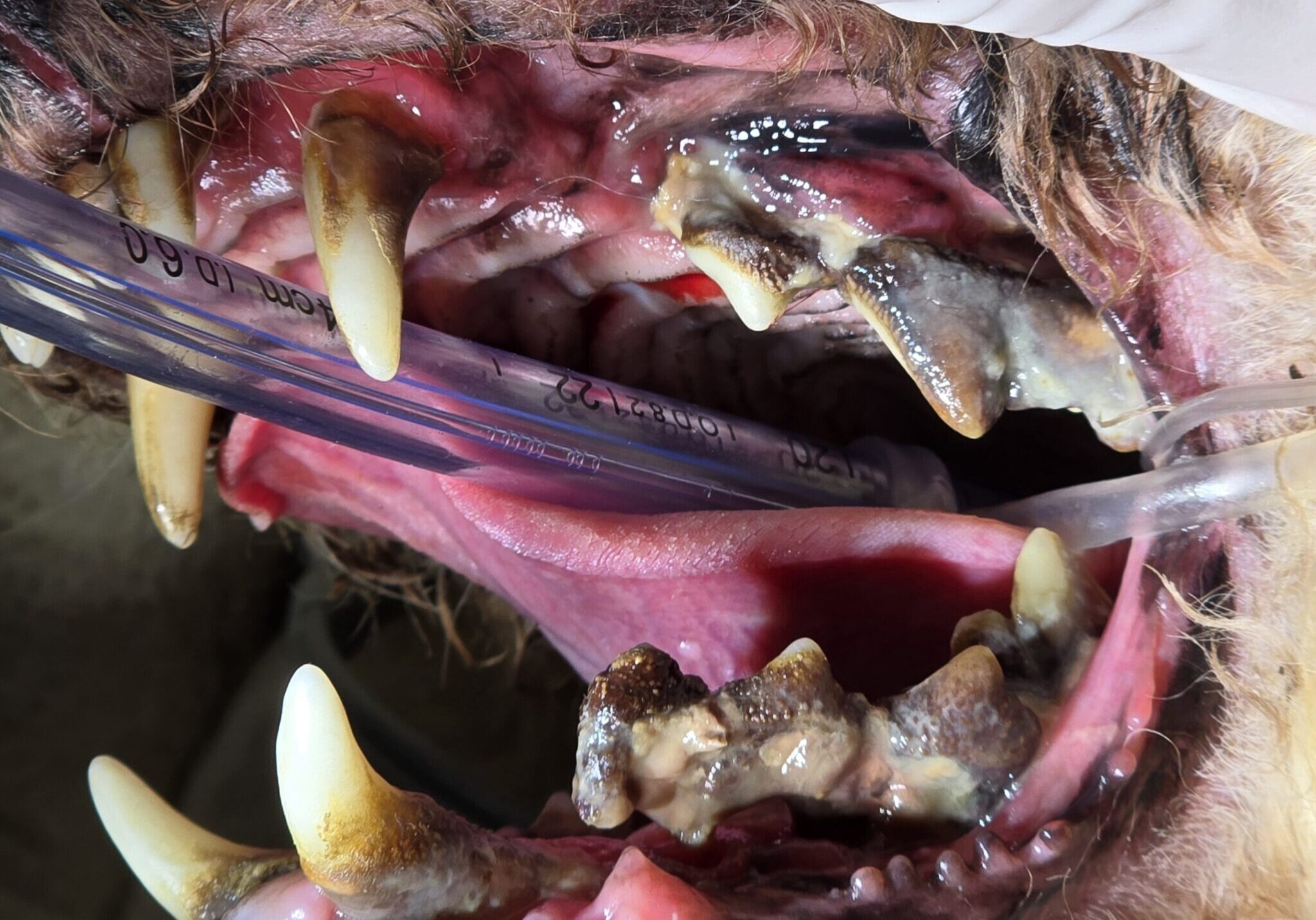 Preoperative Photo Of Severe Periodontal Disease (1)