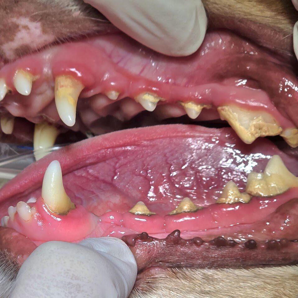 Early Periodontal Disease Before Photo