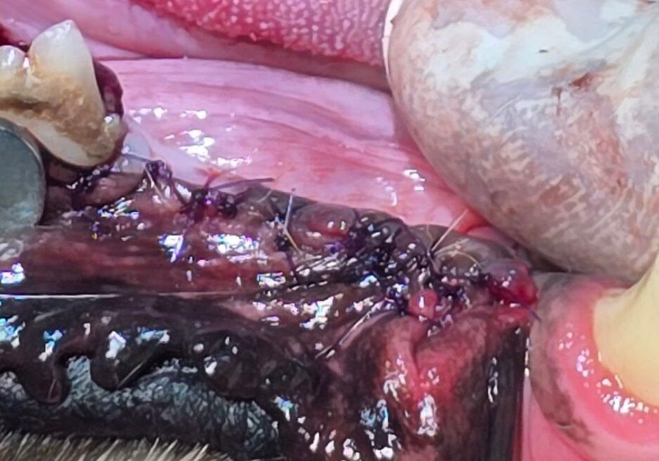 Post Operative Image Of Mass Completeley Removed