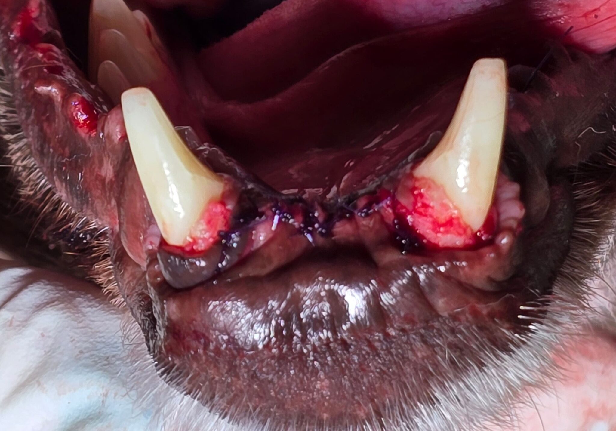 Post Operative Image Of Removed Oral Mass2 Min