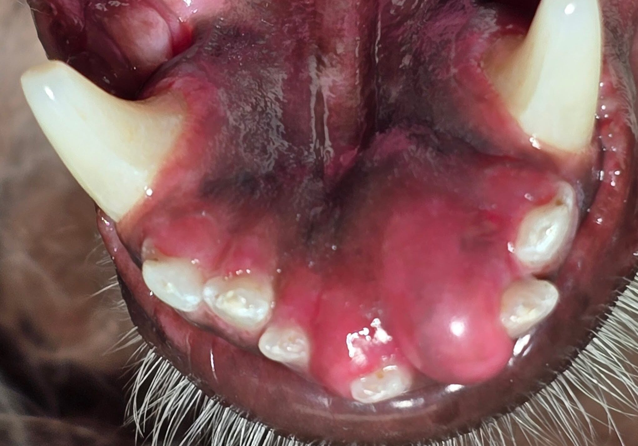 Preoperative Image Of Oral Tumore Displacing Lower Incsors1 Min